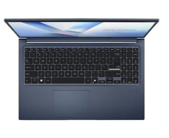 Ноутбук ASUS M1502NAQ-BQ067 (90NB1841-M00810), фото 4